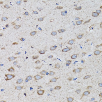 PSMD10 Antibody