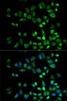 PSMD10 Antibody