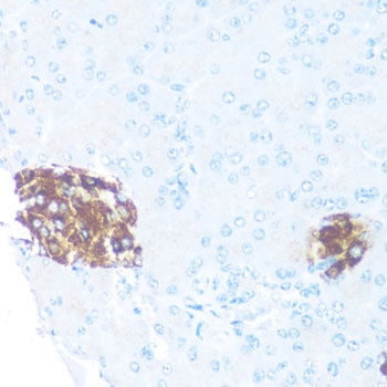 ODC1 Antibody
