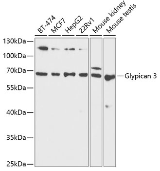 GPC3 Antibody