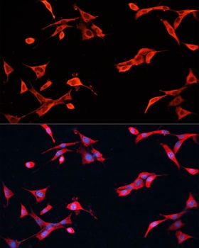 GPC3 Antibody