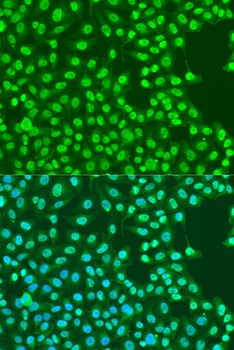 EXO1 Antibody