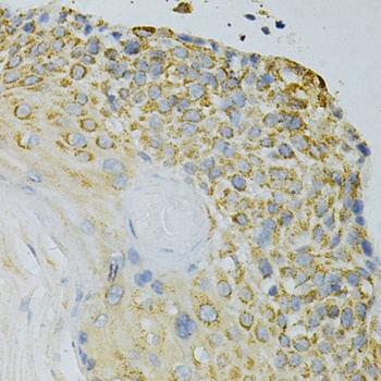 GPX4 Antibody