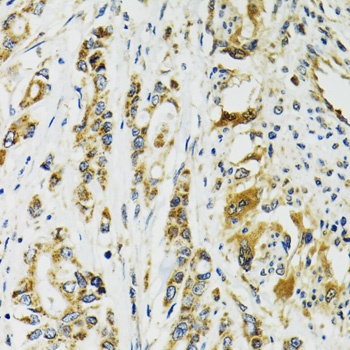 TNNC1 Antibody