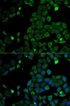 MSR1 Antibody