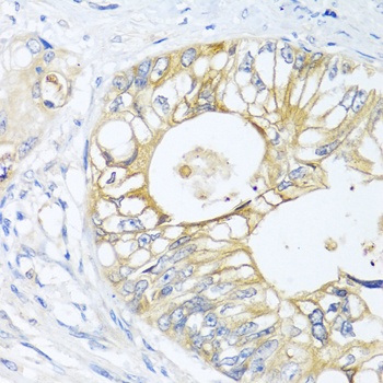 GNAI3 Antibody