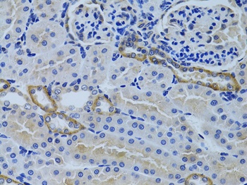 FHL2 Antibody