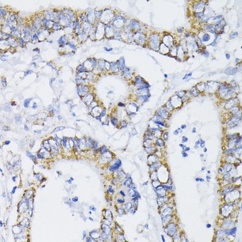 PDHA1 Antibody