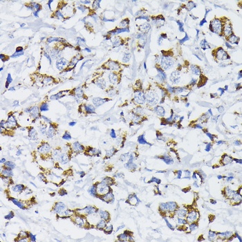 PDHA1 Antibody