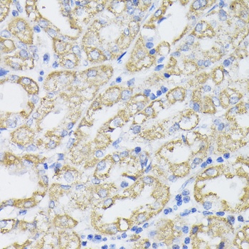 PDHA1 Antibody