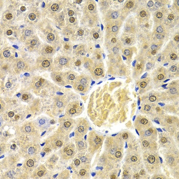 RAD9A Antibody