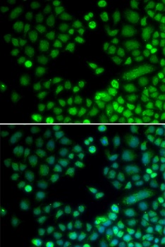 RAD9A Antibody