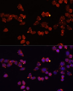 SLC25A4 Antibody