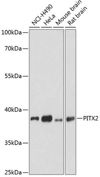 PITX2 Antibody