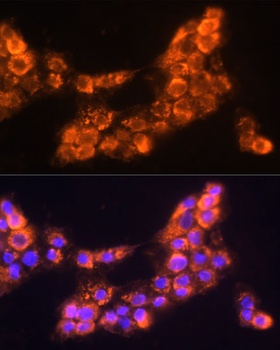 LAMC2 Antibody