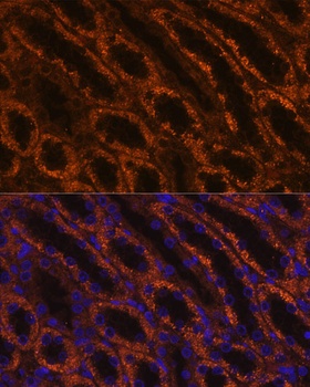 LAMC2 Antibody