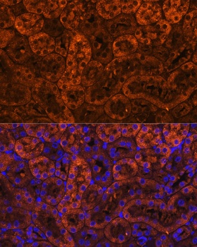 LAMC2 Antibody