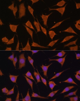 GLB1 Antibody