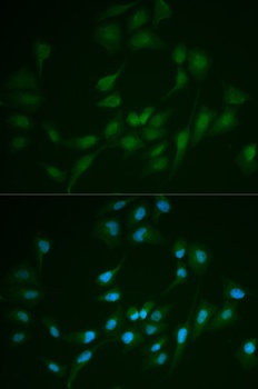 LIG1 Antibody