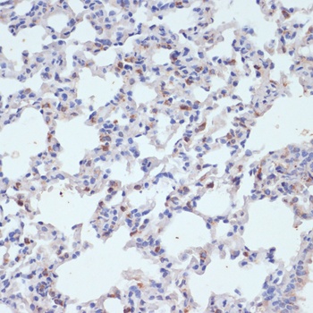 SFTPC Antibody