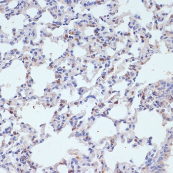 SFTPC Antibody