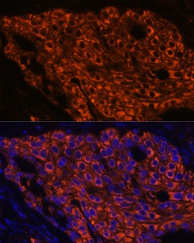 SFTPC Antibody