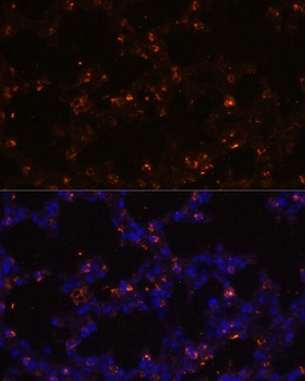 SFTPC Antibody