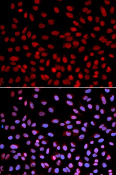 POLH Antibody