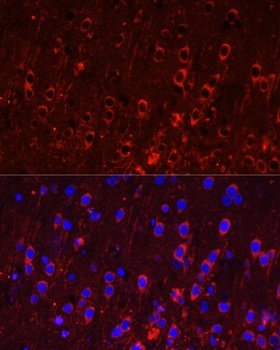 GRIA1 Antibody