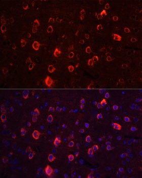 GRIA1 Antibody