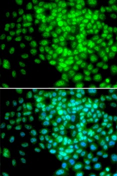 POLR2F Antibody