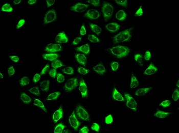 HSD3B2 Antibody