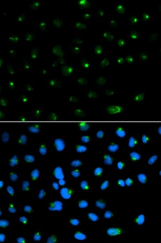 PSAP Antibody