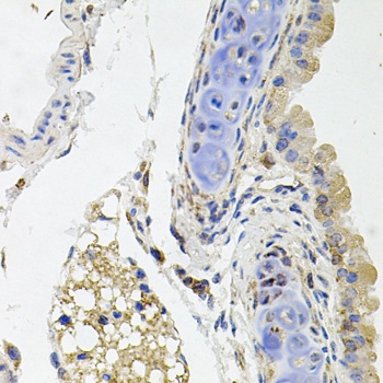 SDC2 Antibody