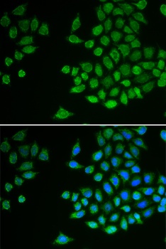 PTPN2 Antibody