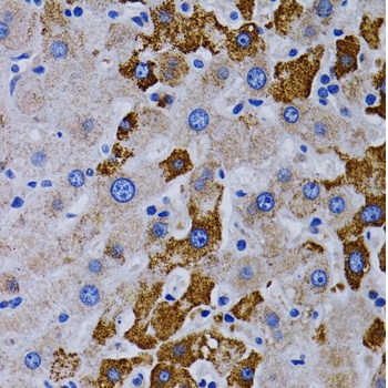 CYP24A1 Antibody