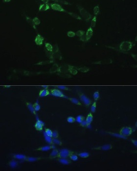 CYP24A1 Antibody