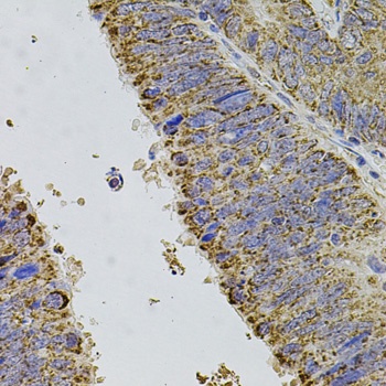 ALDH1A1 Antibody