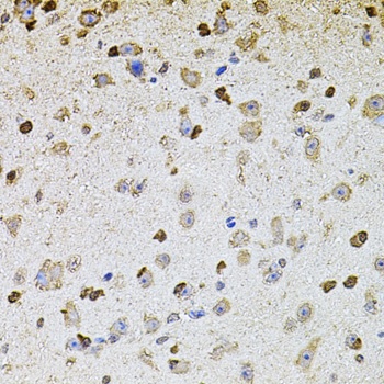 ALDH1A1 Antibody