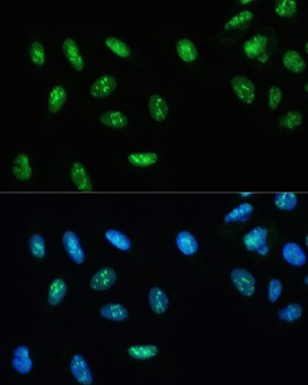 DHX9 Antibody