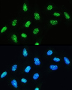DHX9 Antibody