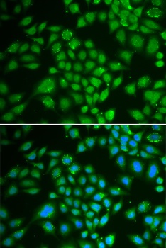 DCK Antibody