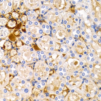 TFF1 Antibody