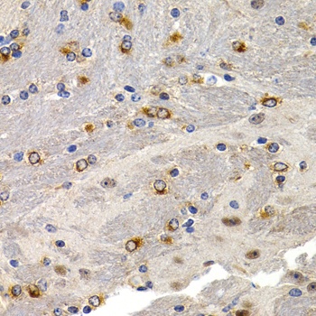 TFF1 Antibody