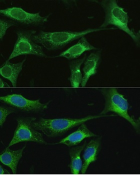 TFF1 Antibody