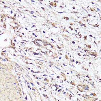 VEGFA Antibody