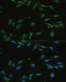 EEF1A1 Antibody