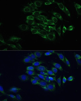 EEF1A1 Antibody