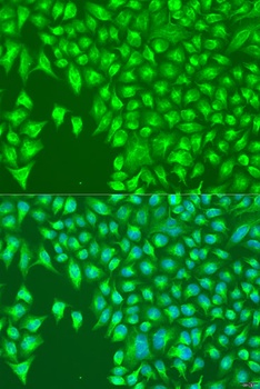 KIR2DS4 Antibody