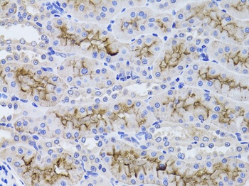 GGT1 Antibody